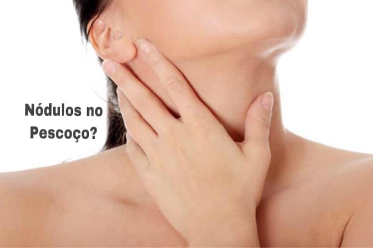 Nódulos no pescoço